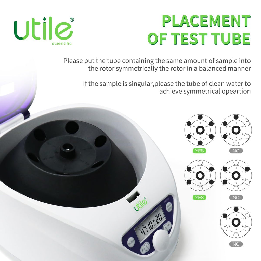 Utile PRP Benchtop Centrifuge Machine LCD Display for Laboratory School