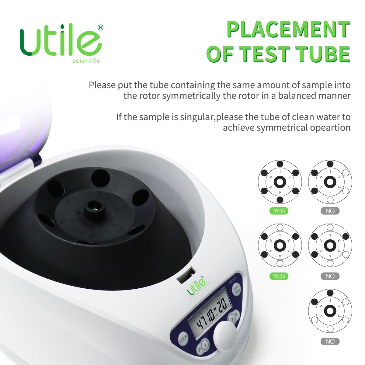 Utile PRP Benchtop Centrifuge Machine LCD Display for Laboratory School