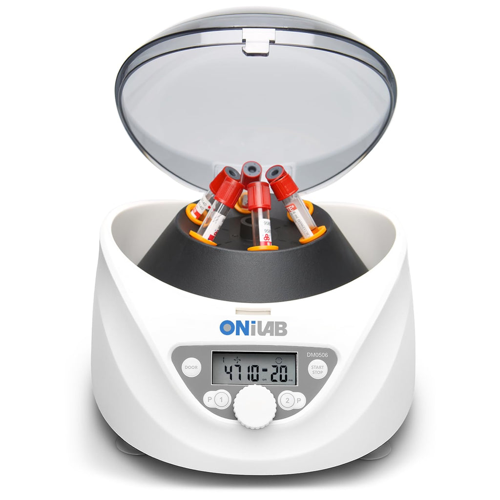 ONiLAB PRP Centrifuge, 8X15ml/10ml/7ml/1.5-5ml, 300-4000RPM, Max 1860Ãg